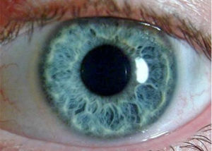 normal pupil size constricted