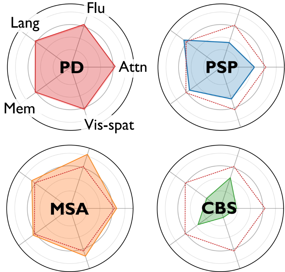 Patterns of cognitive change to diagnose atypical Parkinson’s?